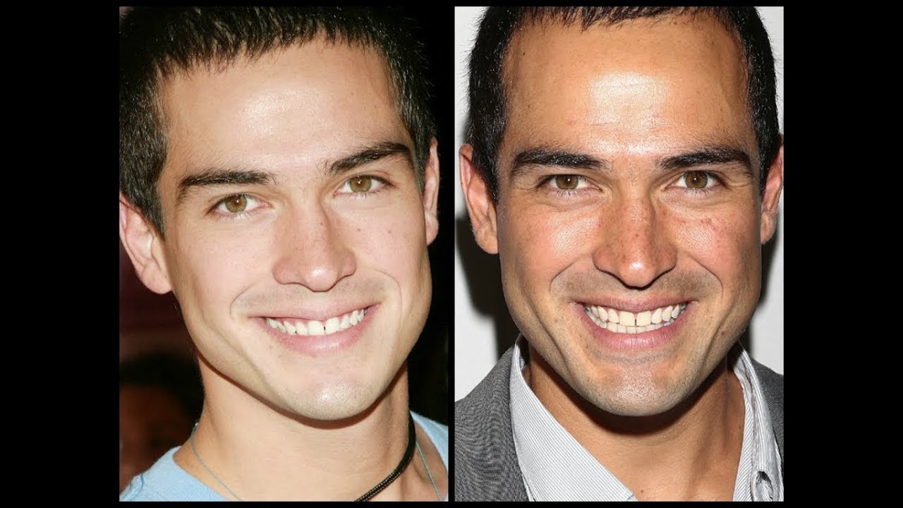 10 Años Desde El Inicio De RBD