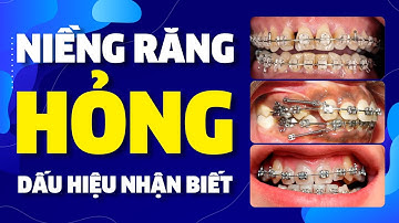 Niềng Răng Hỏng - Dấu Hiệu Nhận Biết & Cách Phòng Tránh | Nam Bùi Vinalign