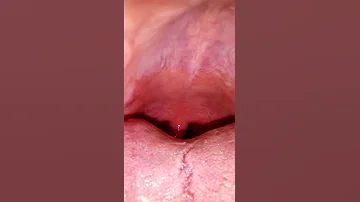 I'm not sure about this... (A Uvula Video) uωu