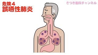 【青森_十和田市_歯医者】実はコワイ！歯垢が引き起こす５つの危険_さつき歯科チャンネル036（口腔ケアチャンネル）