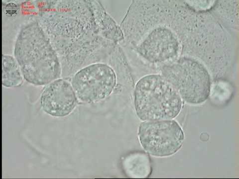 Video: Infeksioni Protozoar (Trichomoniasis) Në Macet