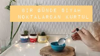 SİYAH NOKTA VE SİVİLCELERİ 1 GÜNDE KURUTAN TARİF / EVDE MASKE YAPIMI