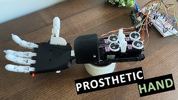 2022: Building a prosthetic arm (Ares Prosthetics)
