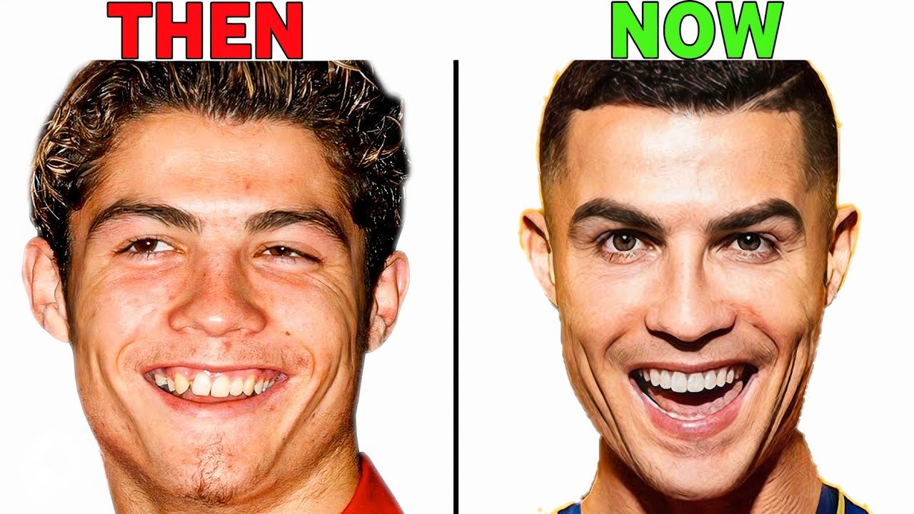 cristiano-ronaldo-new-face-plastic-surgery-analysis-youtube