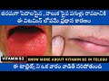 Why Mouth Ulcers Happen Explained in Telugu | Vitamin B2 Deficiency Symptoms in Telugu | Riboflavin