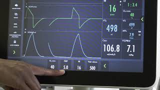 Initial Ventilator Management: Standard/Normal lungs
