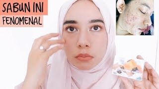 LAGI JERAWATAN PARAH PAKE SABUN PEPAYA RASANYA BEGINI