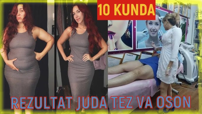 Transseksual Viktoriya