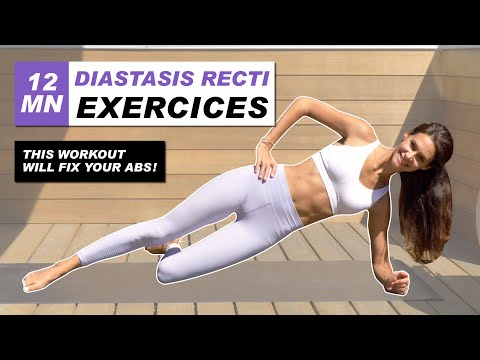 Exercises For DIASTASIS RECTI  BEST 12 Min Workout To Heal Your