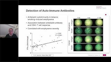 Clinical and Bioanalytical Aspects of Immune Monitoring via ELISpot
