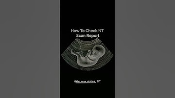 How to check NT scan report#abdomen #baby #ultrasound #babyultrasound #doctor #pregnant #letest
