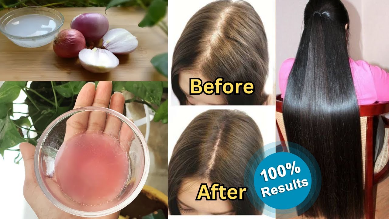 I tried ONION JUICE on my hair FOR 7 DAYS & THIS HAPPENED! *before