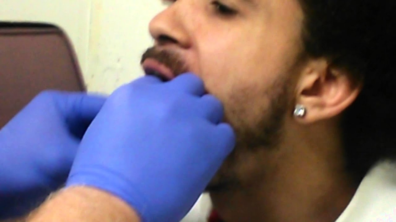 My first tongue piercing January 24