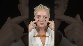 Фейслифтинг. Нижняя блефаропластика. Доктор КОЗЬМЕНКО