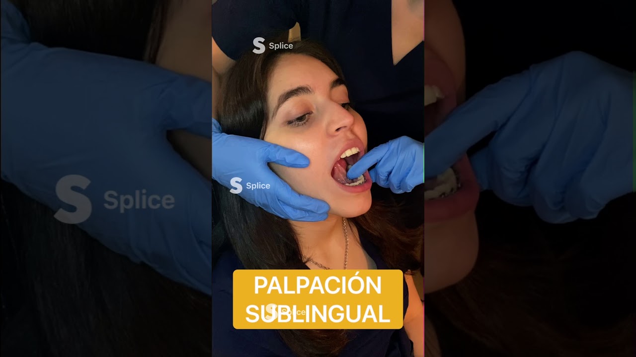 EXPLORACIÓN INTRAORAL Y EXTRAORAL