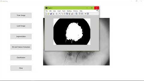 Skin Lesion Classification Matlab Projects