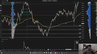 The Setup That Made Me $16,000 Day Trading NQ ($21,000 TopStep Payout)