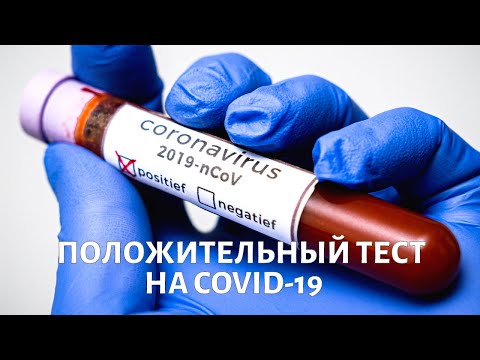 Положительный ТЕСТ НА КОРОНАВИРУС: Что делать?