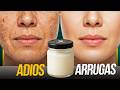 Piel Madura 50+: El Truco con VASELINA para Suavizar Arrugas y Manchas ✨