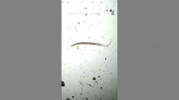 Nematodes under the #microscope #science #biology #worms