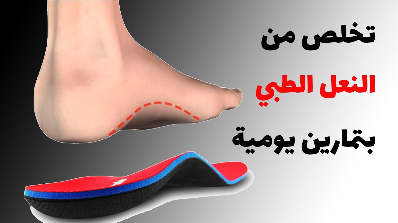 تخلص من النعل الطبي - معلومات هامة للوالدين لضمان سلامة نمو مفصل القدم عند الأطفال - القدم المسطحة