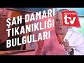 Şah Damarı Tıkanıklığı Belirtileri Nelerdir? Medical Park TV