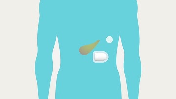 Omnipod® - Basal & Bolus Therapy