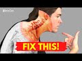 Best Ways to Get Neck Bulging Disc Pain Relief AT HOME