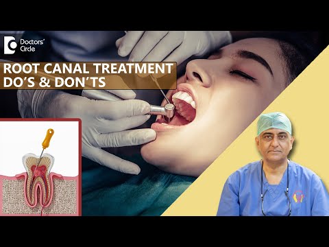 Dos and Don’ts before & after a Root Canal Treatment - Dr. Manesh Chandra Sharma| Doctors' Circle