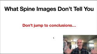 What Spine Images Don't Tell You