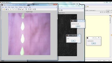 Assistive Clothing Pattern Recognition for Visually Impaired People|ieee projects at bangalore,pune