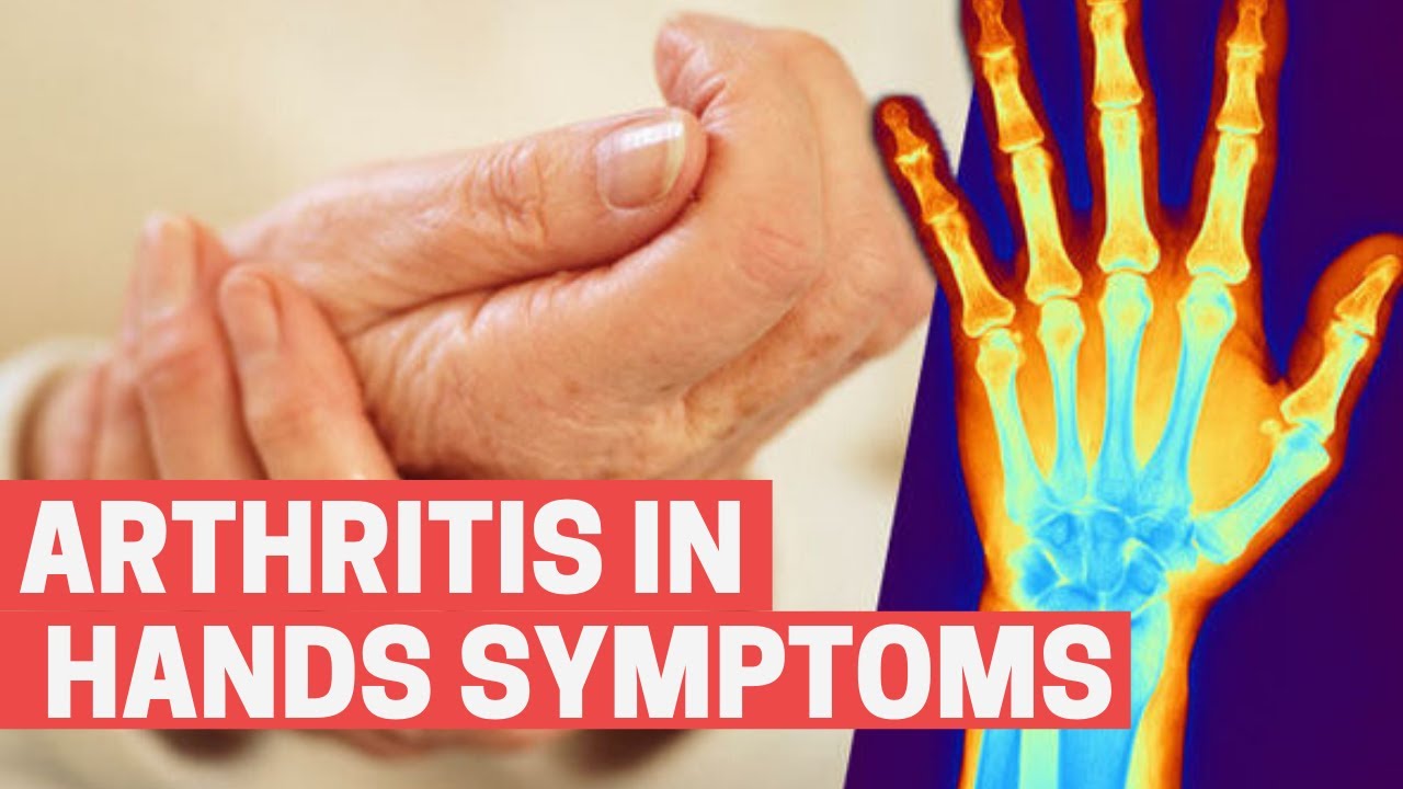 Arthritis In Hands Symptoms What Causes Swollen Hands In The Morning
