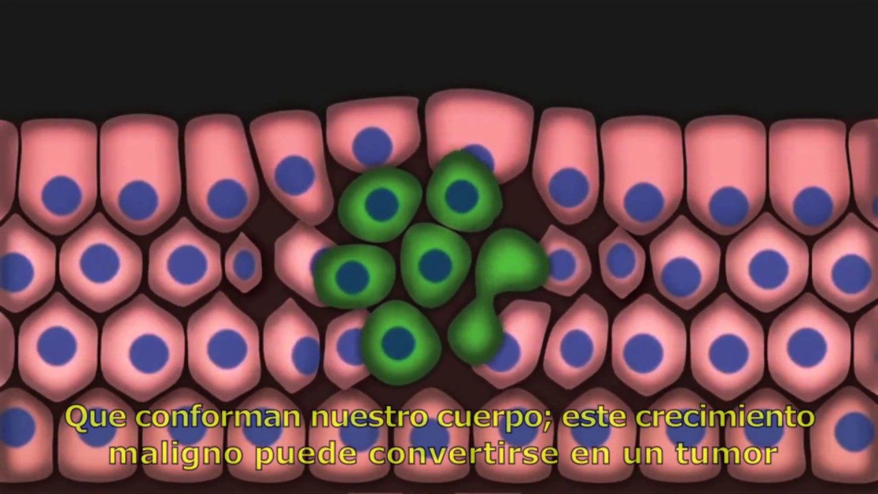 defensa y justicia Detección y atención oportuna de cáncer en las mujeres | Triqui subtítulado al español