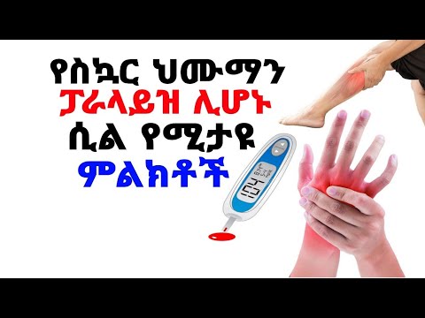 ቪዲዮ: ኮርኔትቶ እና ማቅ ቡት ምን አይነት መሳሪያዎች ናቸው?