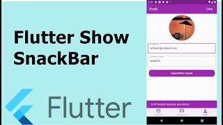 How to use Snackbar in Flutter screenshot 5