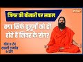 Yoga LIVE: क्या लिवर डैमेज होने पर नहीं हो सकता कंट्रोल ? | Swami Ramdev | liver Disease | Live