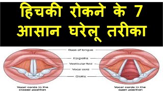 हिचकी बंद करने का 7 सबसे आसान तरीका, how to get rid of hiccups, hichki kyu aati hai aur iska ilaj,