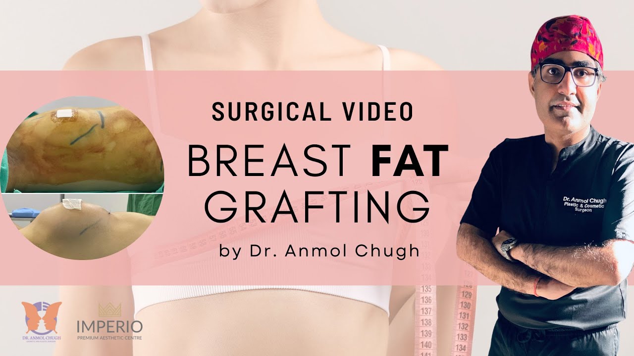 Fat Transfer Breast Augmentation Las Vegas Breast Fat Grafting | Breast Implants or Breast Fat Transfer | Plastic