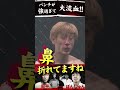 鼻が折れて大流血!!朝倉未来も認める強烈パンチ!! #shorts