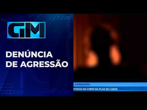 mãe relata hematomas em filha de 3 anos