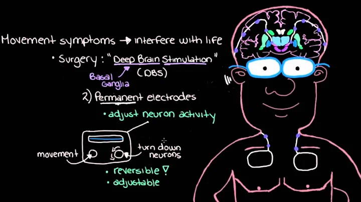 Khan Academy - Managing Parkinson's Disease with S...