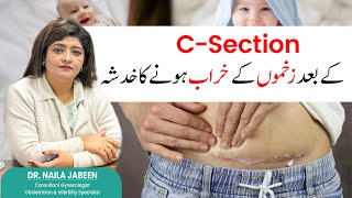 Understanding C-Section Wound Complications