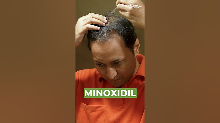 Dr. Agni, Dermatologist explains the real reason why minoxidil causes increased hair fall