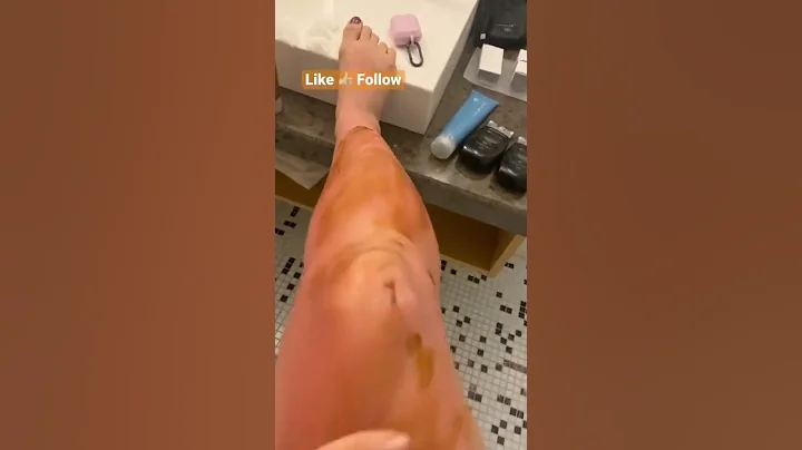 Have you ever been Sunburned?  #hack #sunlesstanni...