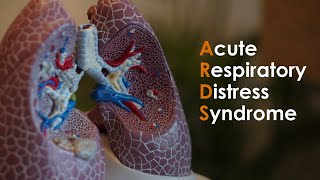 Acute Respiratory Distress Syndrome (ARDS) for USMLE Step1 and USMLE Step 2