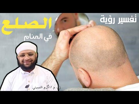 تفسير رؤية الصلع في المنام  أكرم الدميني        