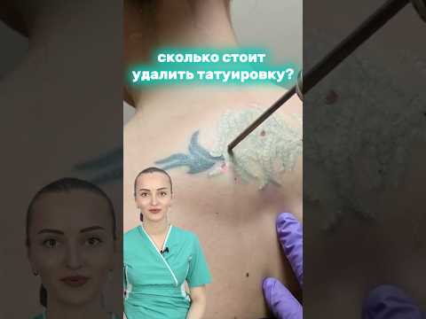 Можно Ли Свести Тату Полностью Сколько Стоит Удаление