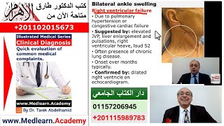 Bilateral Ankle Swelling #usmle #internal_medicine #cme #محاضرات_باطنة  #medicine screenshot 5
