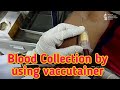 Blood collection by using vaccutainer method.closed system of blood collection.