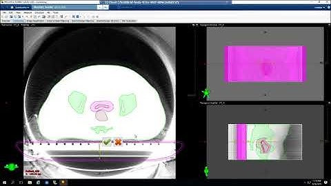 Eclipse 16 1 Countouring